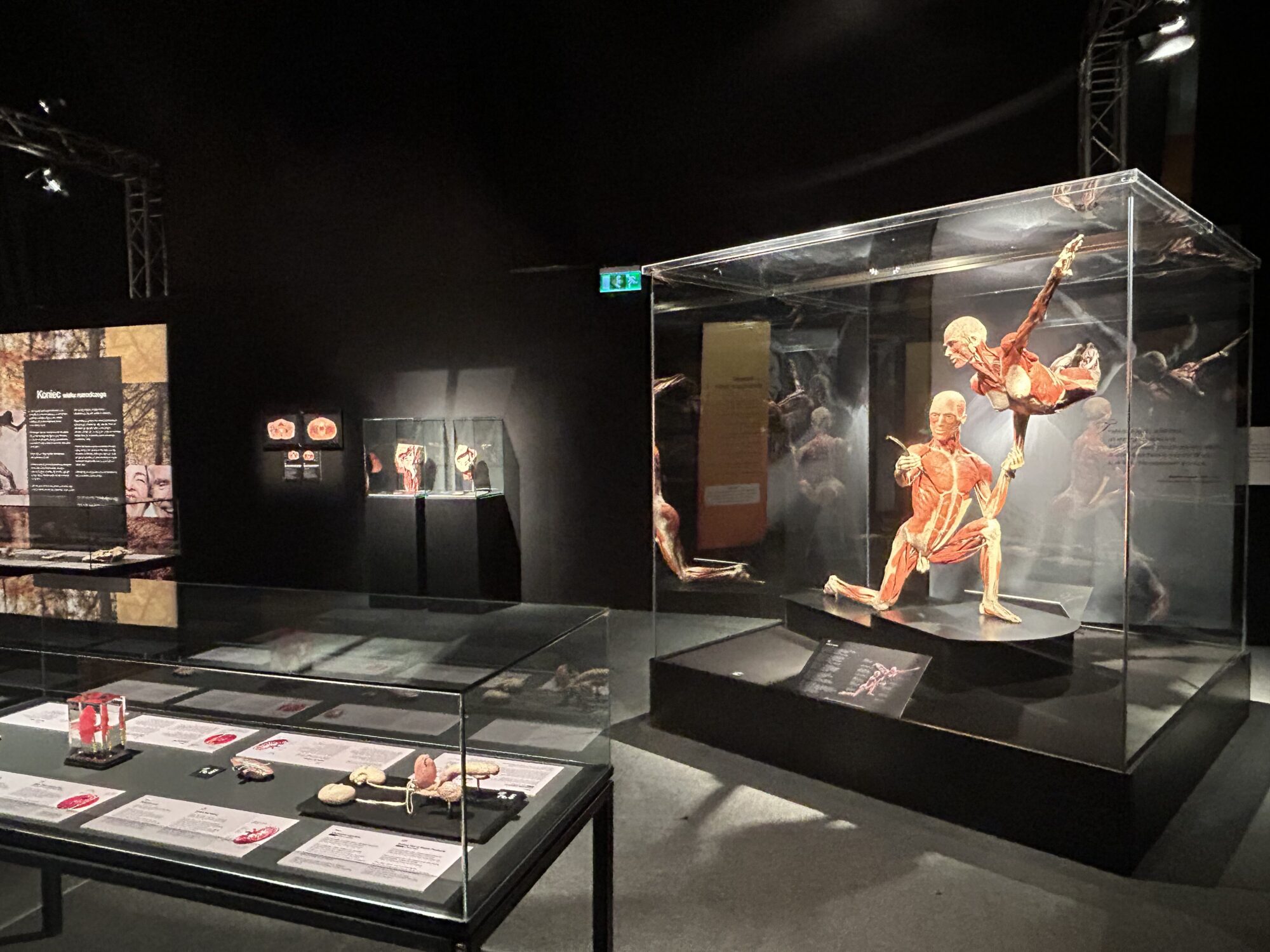 Body Worlds wraca do Wrocławia. Dlaczego budzi tyle emocji?