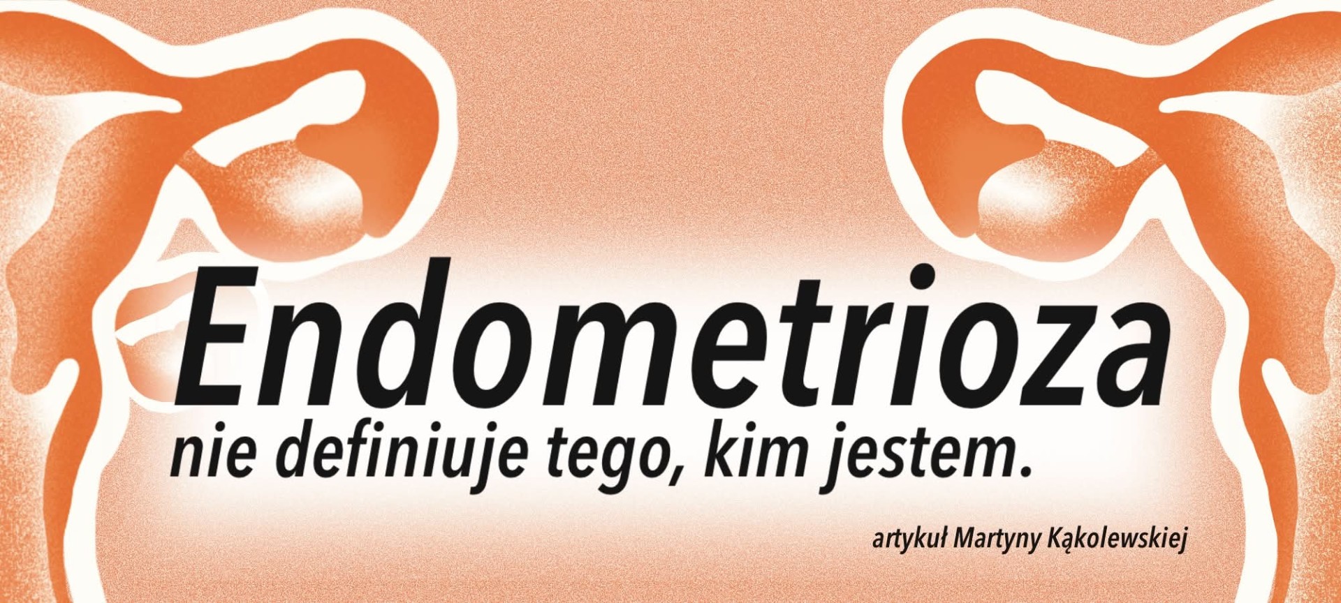 Endometrioza nie definiuje tego, kim jestem